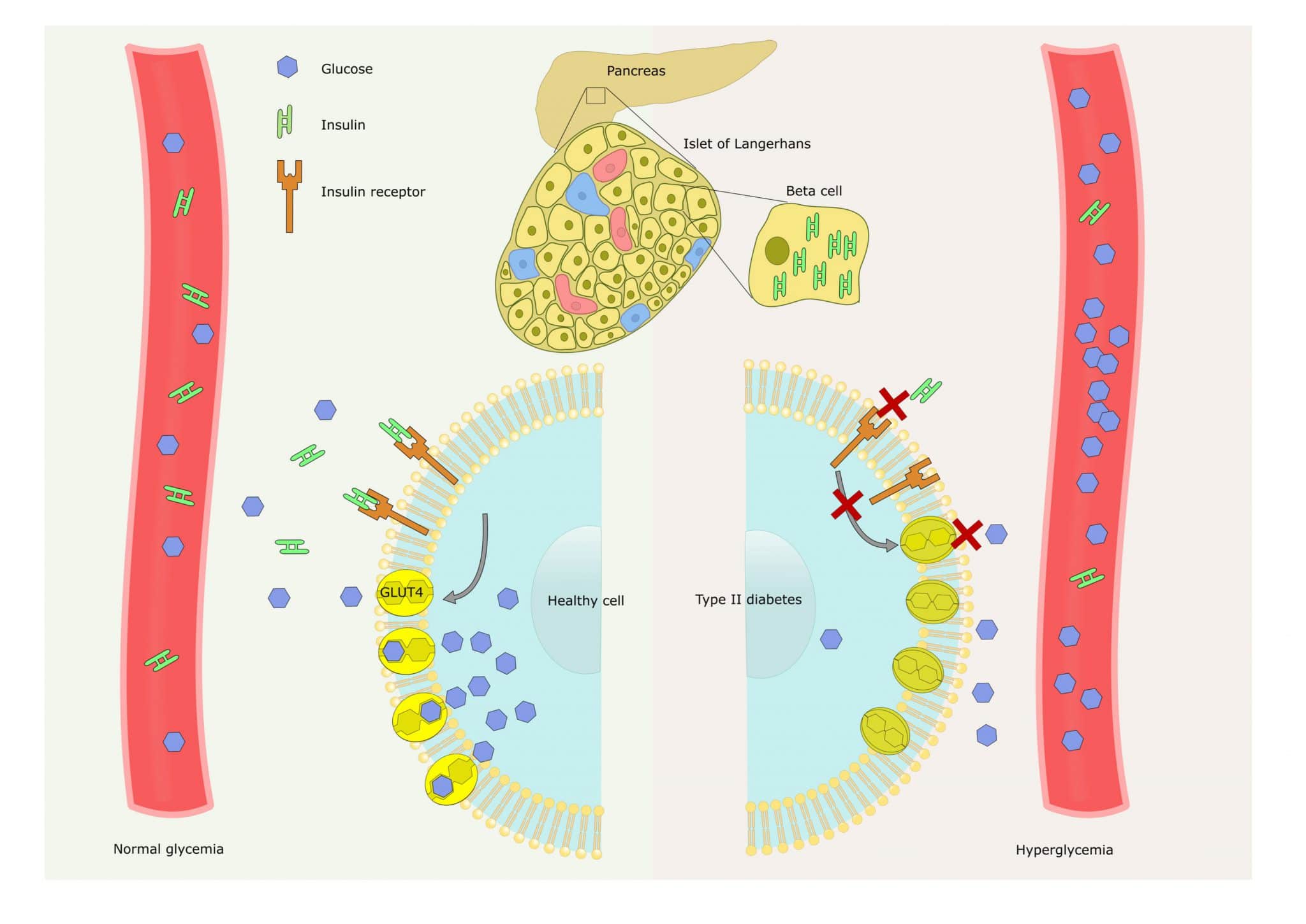 schedule to explain Insulin resistance