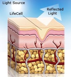 Does Lifecell work?