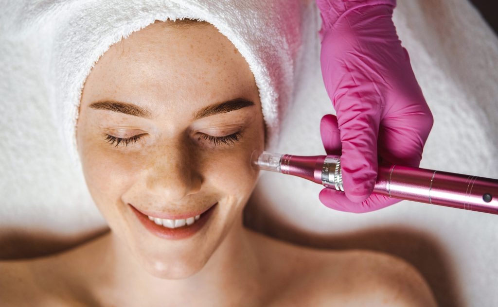 Microneedling is The Number One Hollywood Anti-Aging Treatment