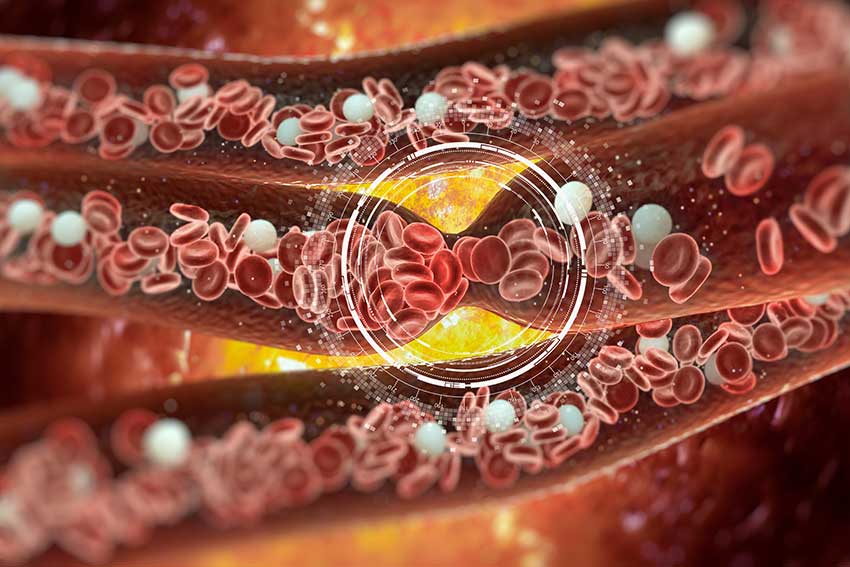 World Heart Day: Can Liposomal Vitamin...