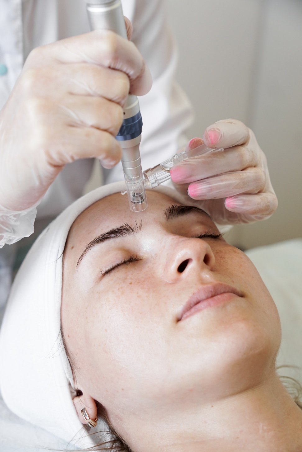 What is our Glass Skin Microneedling...