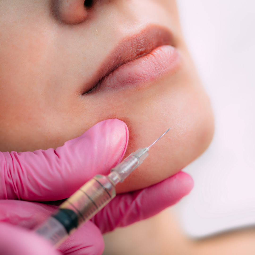Dissolving Filler 101