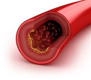 How to Manage 12 Cardiovascular Risk...