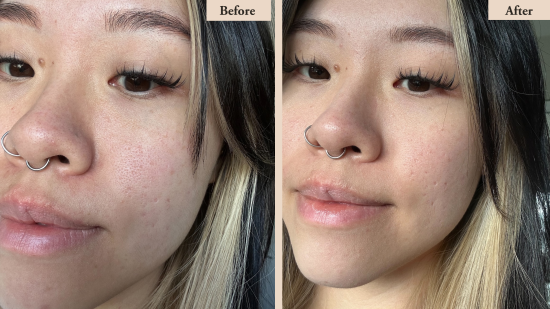 Best Facial Cleanser For Oily Skin?...