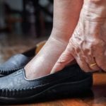 Leg Swelling in Aging: What to...