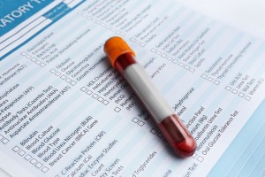 Top 10 Blood Tests for Older...