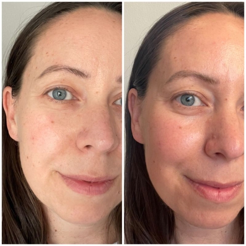 Alyssa before and after of her face