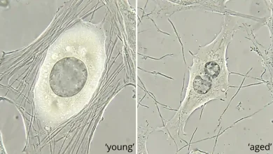 Aging
